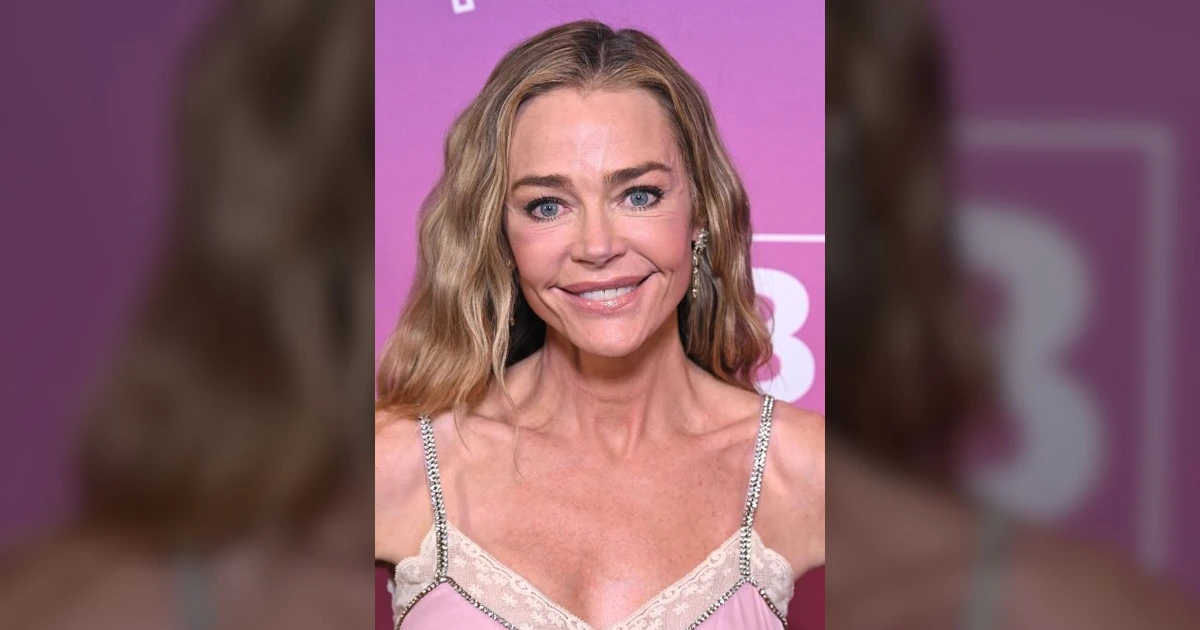 Denise Richards breaks down details of her facelift